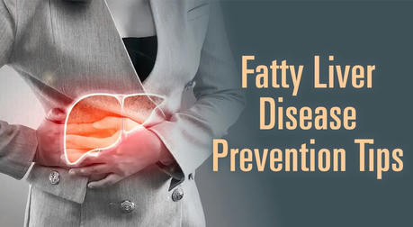 Prevent Fatty Liver Now: Protect Your Liver and Your Life in the U.S.